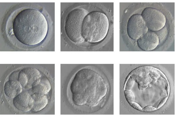 The embryo divides and develops from a single fertilised egg top left to a blastocyst bottom right